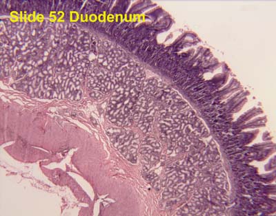 Pathology Outlines - Histology-small intestine